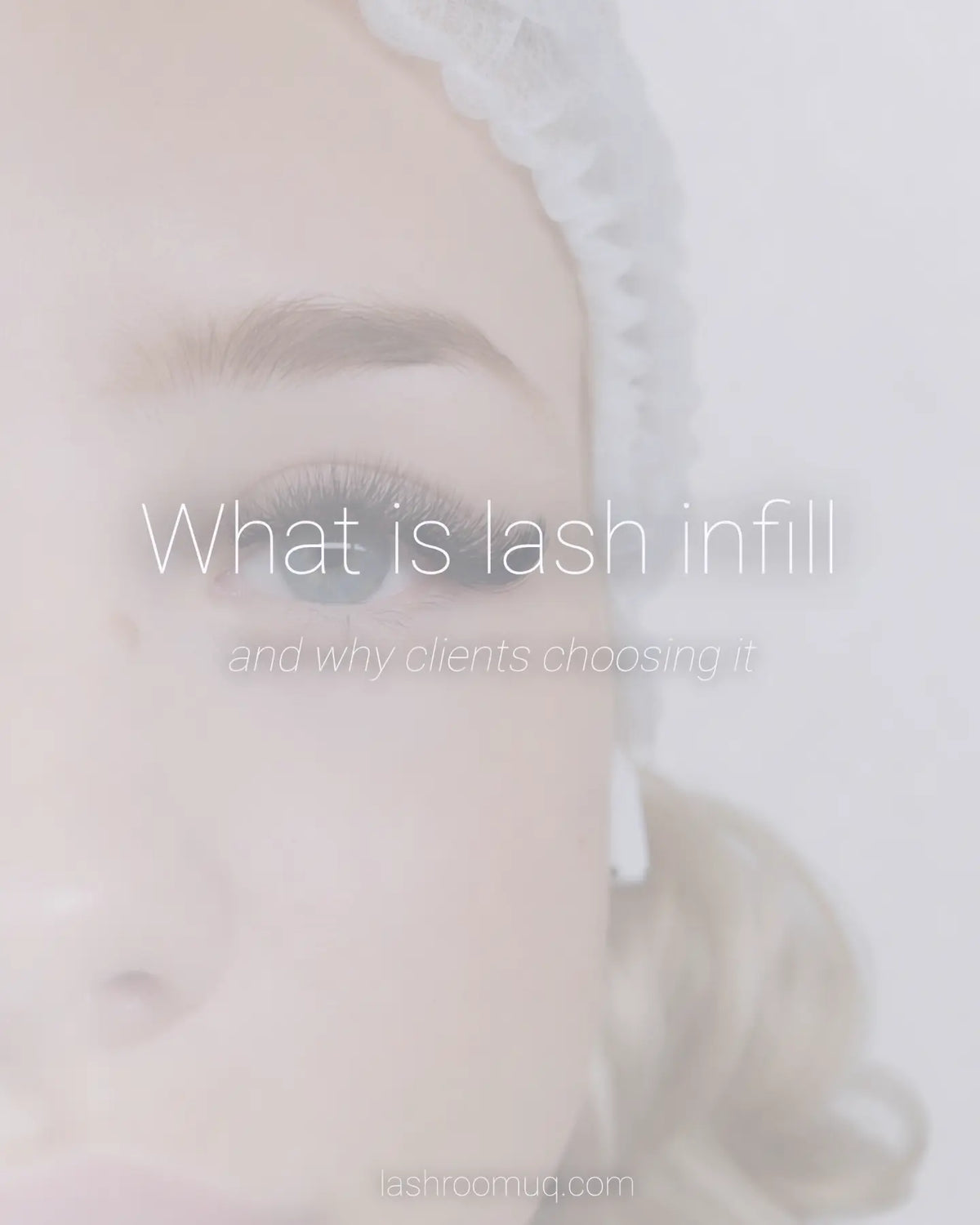 Infills and their Benefits (3 min read)